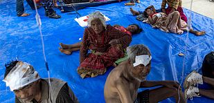 Las víctimas del terremoto de Nepal reciben tratamiento al aire libre, en Dhading Besi. Las víctimas del terremoto de Nepal reciben tratamiento al aire libre, en Dhading Besi.