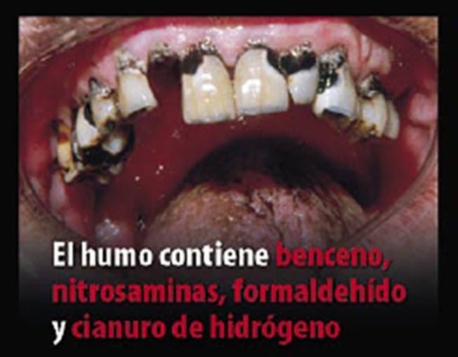 http://img.rtve.es/imagenes/fotos-tabaco/1273834144961.jpg