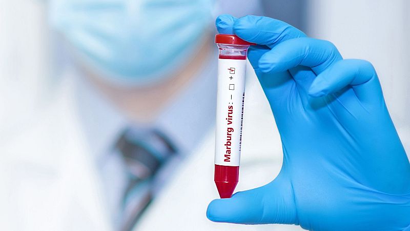 Marca España - Nuevas vacunas contra el virus de Marburgo - 17/01/24 - Escuchar ahora