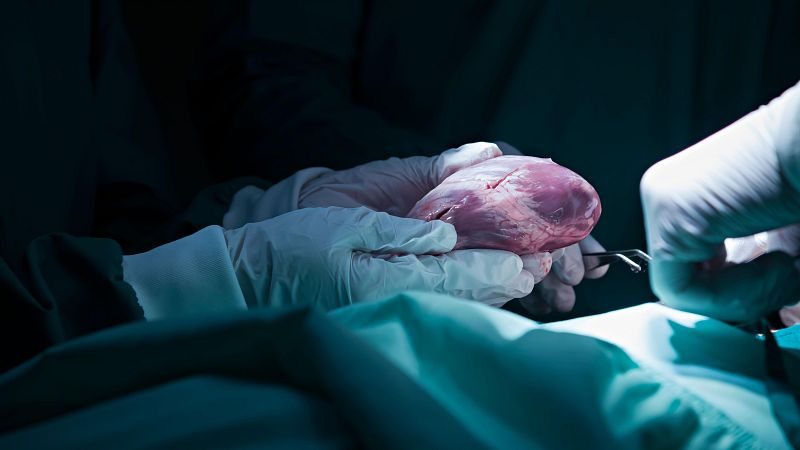 Por tres razones - Tres años después, el corazón de Irene late sin rechazo