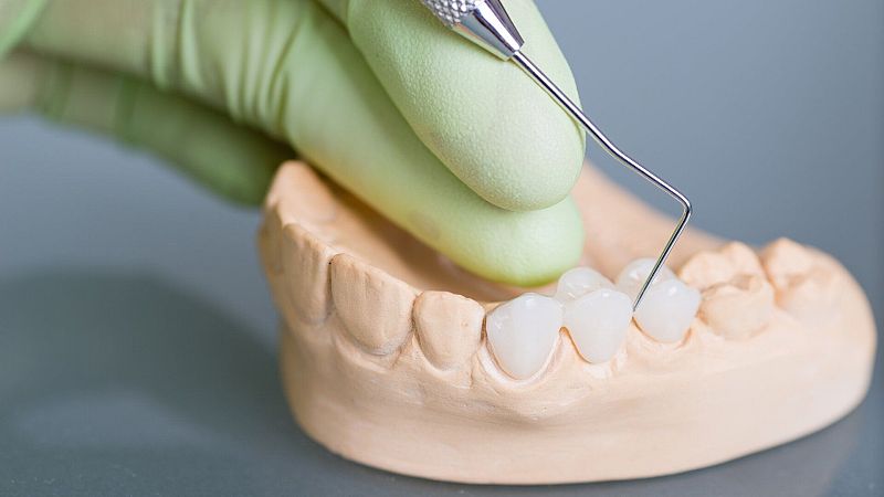 El gallo que no cesa - Médico de guardia: Para qué se usan las coronas dentales - Escuchar ahora