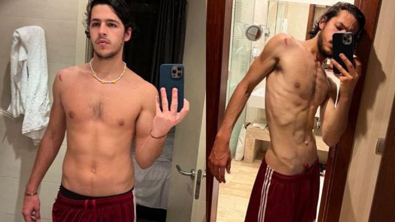 Por tres razones - Antonio Escribano Ocón: "Algunos actores llegaron a perder 30 kilos" - Escuchar ahora