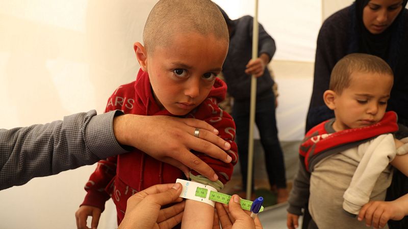 Cinco continentes - El hambre sigue siendo una realidad en 2024