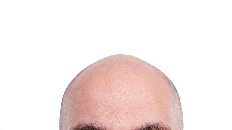 Las cosas de Ana - Una de calvos con amor y con humor - 31/03/24 - Escuchar ahora