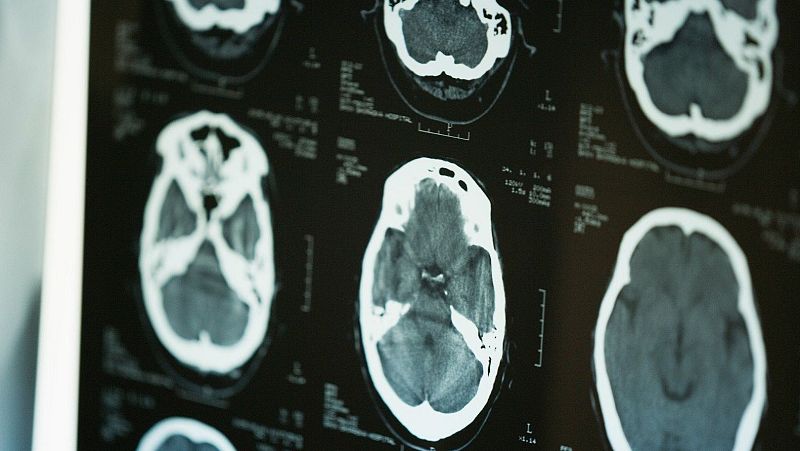 Las mañanas de RNE con Iñigo Alfonso - ConELA: "Es importante incluir enfermeros a domicilio en este texto" - Escuchar ahora