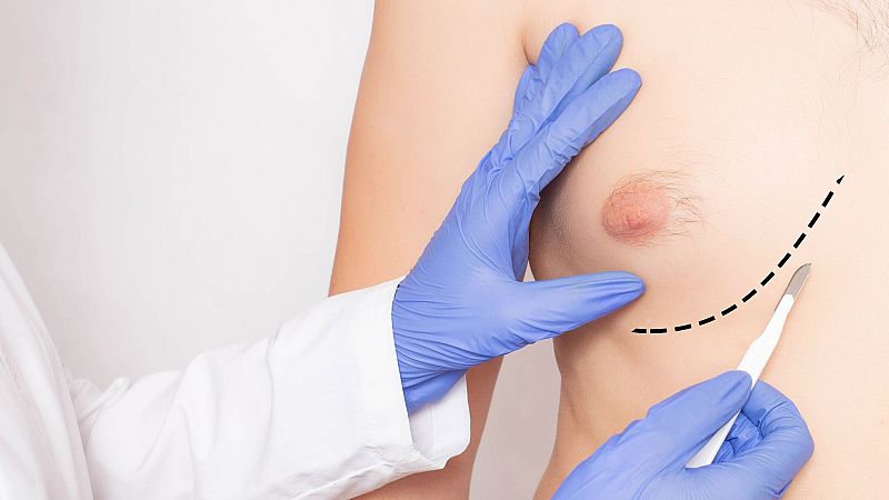 Reportajes Emisoras - Toledo - Cáncer de mama en hombres - 02/05/24