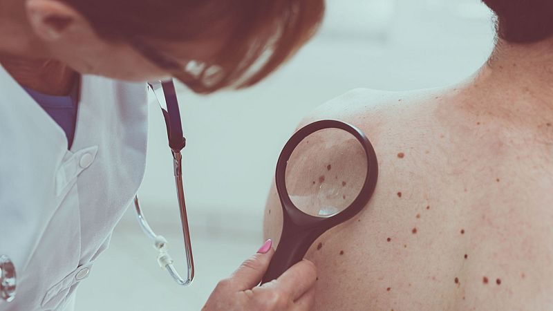 Crónica de Andalucía: "El cáncer de piel está siendo casi una epidemia" - Escuchar ahora