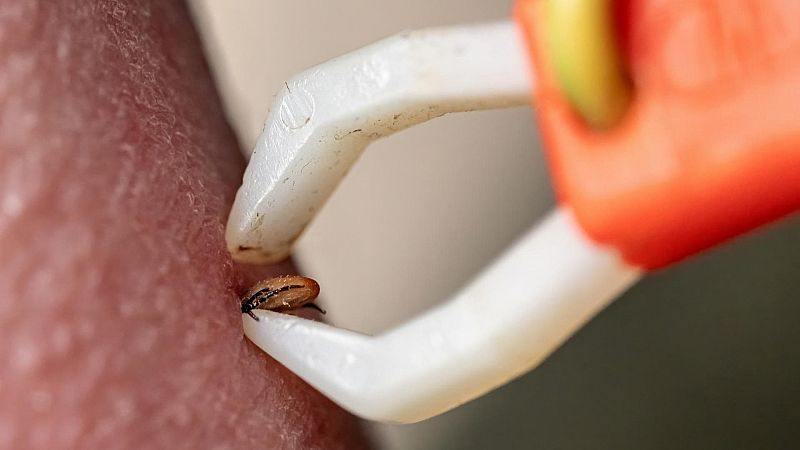 A su salud - Cambio climático, garrapatas y enfermedad de Lyme - 17/07/24