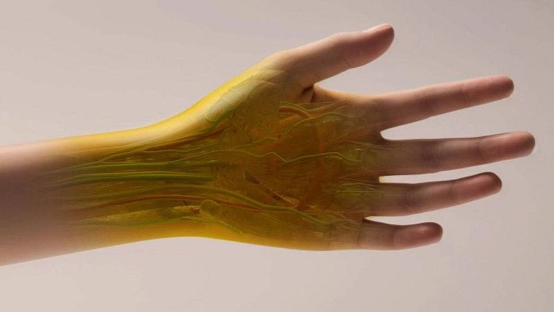 Las mañanas de RNE - Un colorante para decolorar la piel - Escuchar ahora