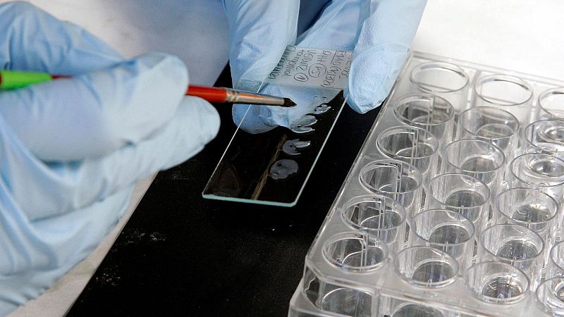 Las mañanas de RNE con Josep Cuní - El objetivo es poder prevenir el Parkinson - Escuchar ahora