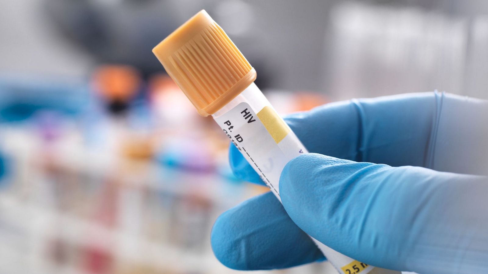 Es constata l'alta efectivitat dels nous tractaments antiretrovirals | ANNA BAÑERES