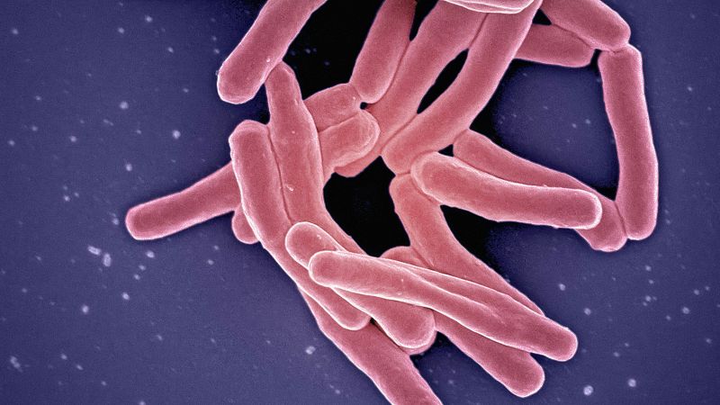 Salut Pública investiga un brot de tuberculosi que ha afectat a 25 persones a Barcelona