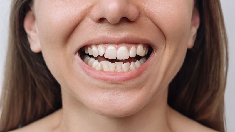 Cerca del 70% de la población no muerde bien - Escuchar ahora