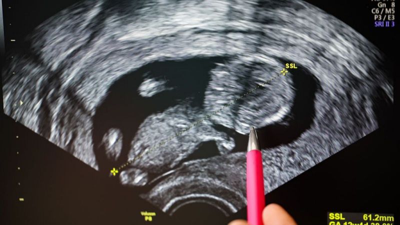 Ana Trejo (STOP Vientres de Alquiler): "La nueva práctica es un paso importante en la abolición de la gestación subrogada"