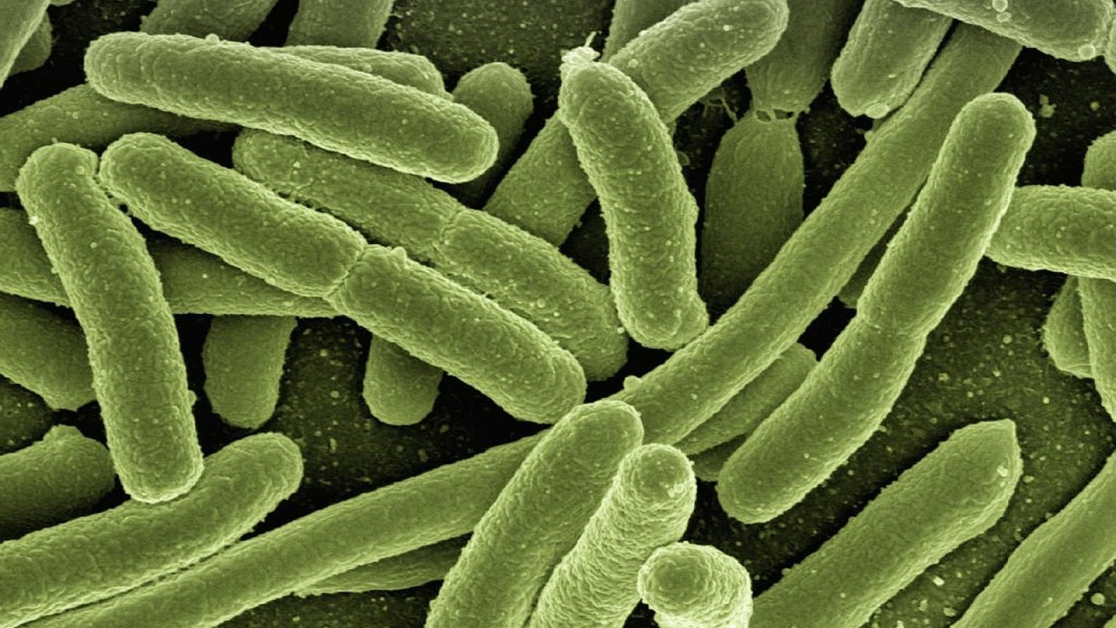 Las Mañanas de RNE - Una bacteria es capaz de convertir plásticos en paracetamol - Escuchar ahora