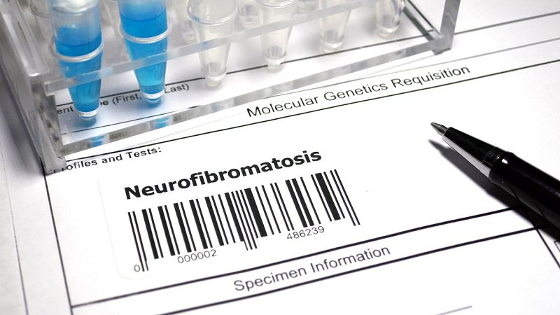 Fin de mes - Neurofibromatosis tipo 2 y trabajo - Escuchar ahora