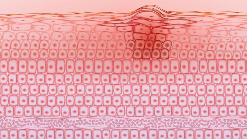 Engañar a las células para combatir el melanoma - Con bata blanca | Escuchar