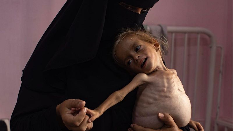 "La de Gaza es una hambruna genocida " - Las mañanas de RNE | Escuchar