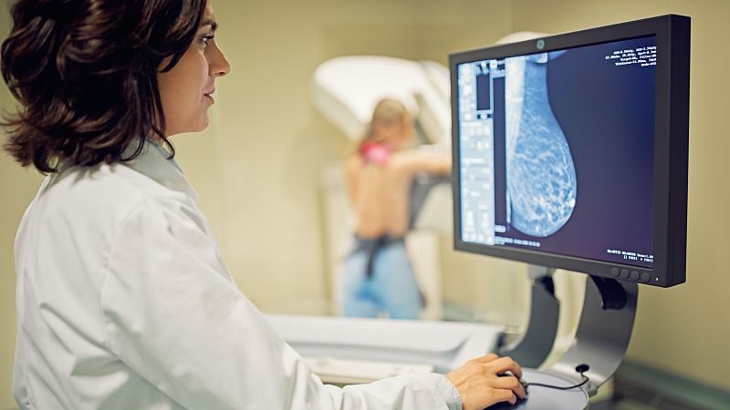 Càncer de mama metastàtic: viure amb incertesa i lluitar per cronificar-lo