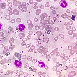 NeuMap, mapa pionero que redefine la visión de la inmunidad