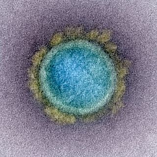 Las regiones críticas del virus SARS-CoV-2, reveladas