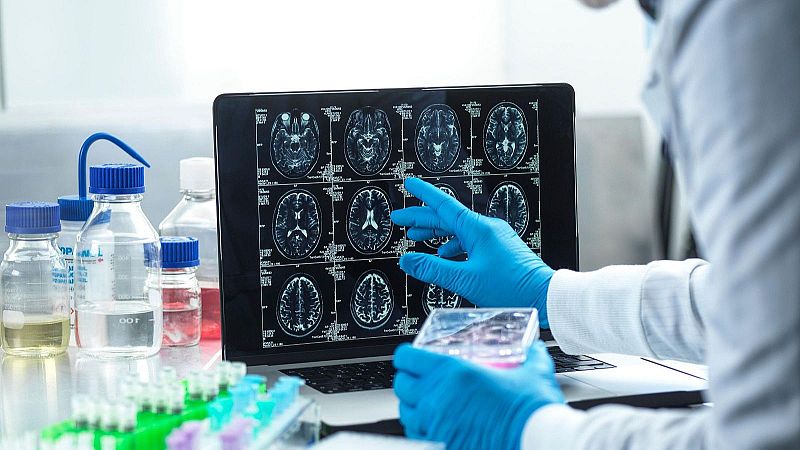 Adelantarse al alzheimer - Las mañanas de RNE | Escuchar