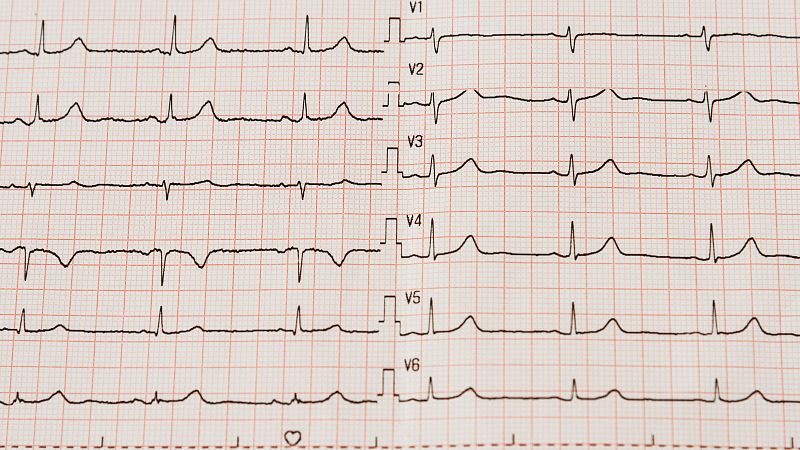 ¿España goza de buena salud cardiovascular? - Marca España | Escuchar