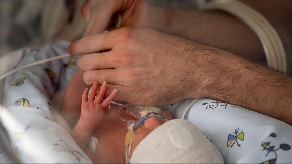 La transfusió de sang de cordó umbilical, més efectiva per a l'anèmia dels prematurs