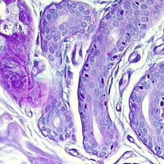 El modelo que mejora el estudio de la enfermedad de Lafora