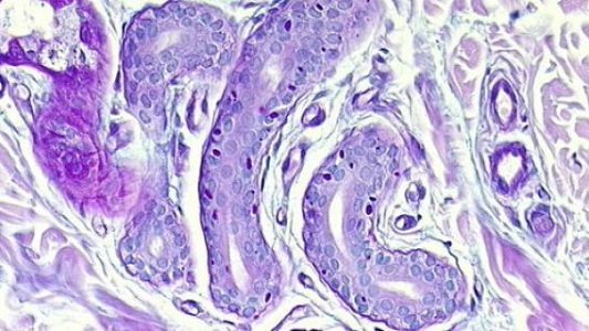 El modelo que mejora el estudio de la enfermedad de Lafora