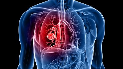 Dos generaciones juntas contra el cáncer