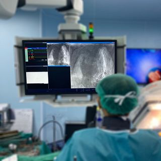 Tratar válvulas cardiacas mecánicas defectuosas sin cirugía