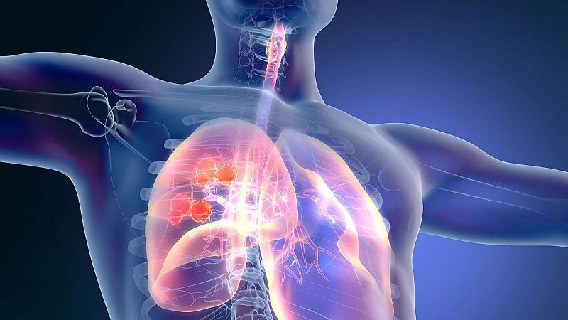 El mat� de R�dio 4 - Mat� o tarda? Un estudi apunta en quin moment del dia s�n m�s efectius els tractaments conta el c�ncer - El mat� de R�dio 4 | Escoltar