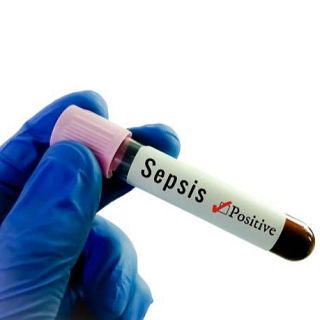 Avances en sepsis