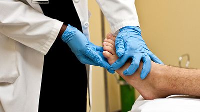 UNAM y CNIO publican un informe sobre el melanoma acral