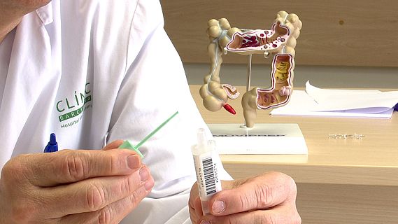 Nom�s la meitat de la poblaci� participa en el cribratge de c�ncer colorectal