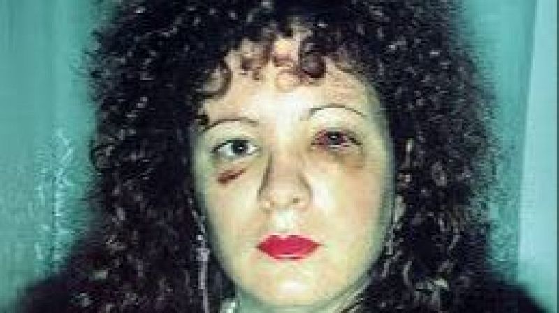 40 años de la balada de Nan Goldin, la serie más famosa de la fotógrafa americana - El ojo crítico | Escuchar