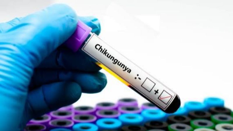 El laboratorio de JAL - El virus que te deja doblado - 02/04/26 - Escuchar ahora