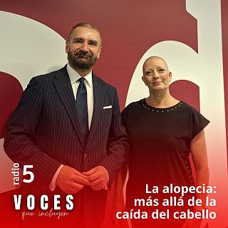 La alopecia: más allá de la caída del cabello