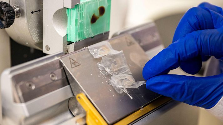 Escamas de peces para regenerar la córnea humana