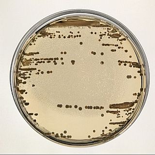 Resistencia a antibióticos: hallada nueva clave en plásmidos