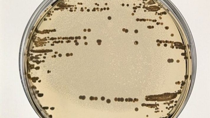 Resistencia a antibióticos: hallada nueva clave en plásmidos