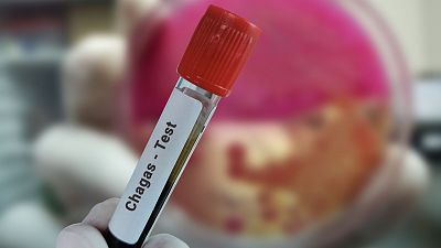 El Chagas: la enfermedad que ya no es exclusiva de LATAM