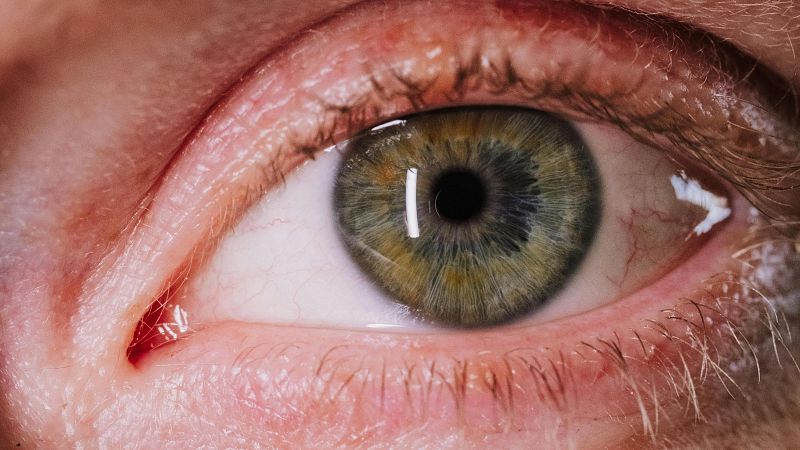 El mat� de R�dio 4 - Et piquen els ulls a la primavera? Descobreix com alleujar els s�mptomes! - El mat� de R�dio 4 | Escoltar