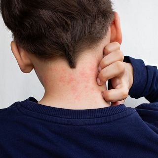 Contra la anafilaxia y alergias 'Cada Minuto Cuenta'