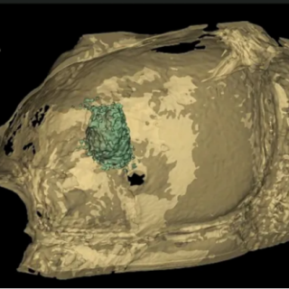 Biomateriales: Ingeniería de Caminos imitando la vida