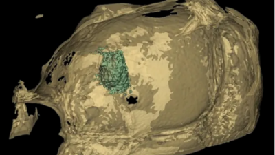 Biomateriales: Ingeniería de Caminos imitando la vida