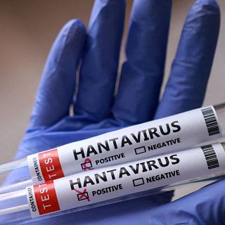 Dra. Judit Villar: "L'hantavirus es transmet a través d'un contacte estret i prolongat. No té res a veure amb la covid-19"