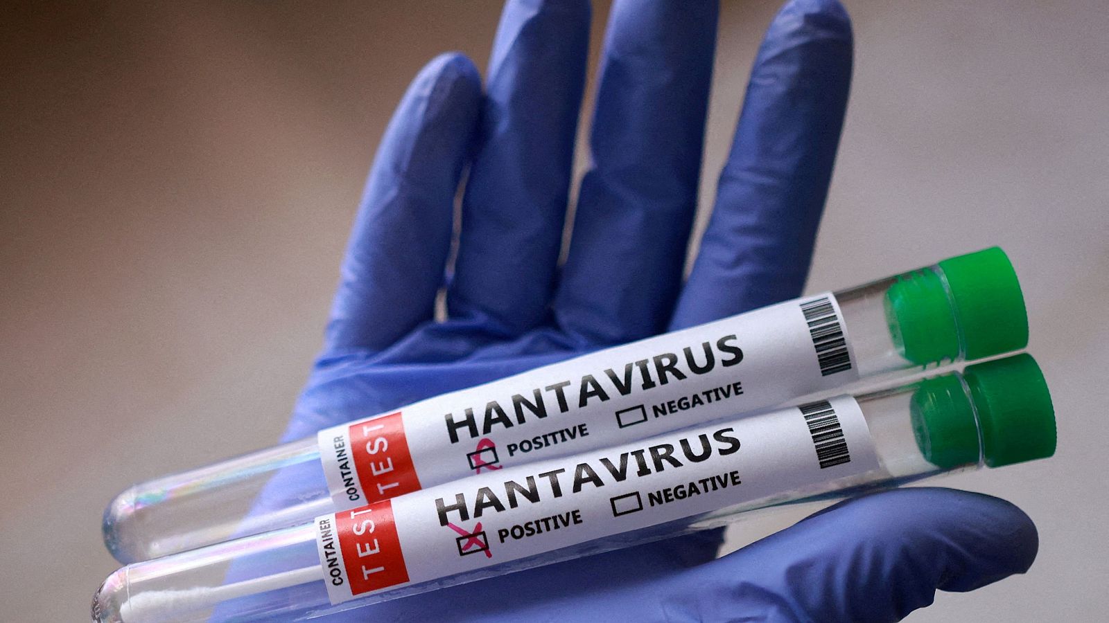 Dra. Judit Villar: "L'hantavirus es transmet a trav�s d'un contacte estret i prolongat. No t� res a veure amb la covid-19"