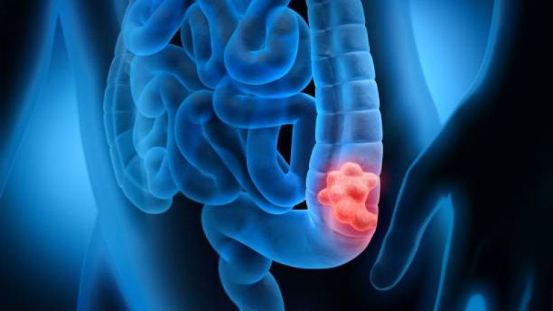 El laboratorio de JAL - Diagnóstico del cáncer colorrectal - 21/05/26 - Escuchar ahora